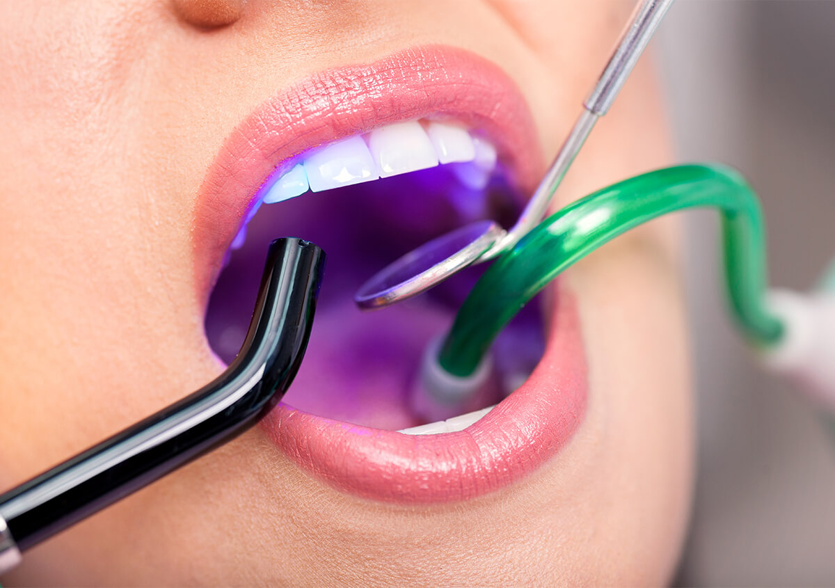 Dental Laser Therapy in Menomonie WI Area